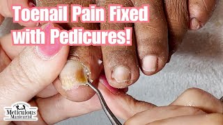 Pedicure Beauty Series No More Painful Toenails [upl. by Nalorac]