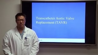 What Is Transcatheter Aortic Valve Replacement  William Suh  UCLAMDChat [upl. by Teodorico]