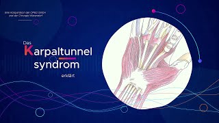 Chirurgie Warendorf Das Karpaltunnelsyndrom erklärt  Handkonzept [upl. by Hterrag]