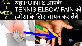 ACUPRESSURE POINTS For TENNIS ELBOWSUJOK THERAPY For Elbow PainTennis Elbow Treatment In Hindi [upl. by Nnylrahc242]