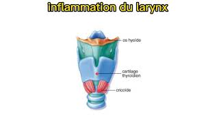 laryngite aiguë pédiatrie [upl. by Tadeo]