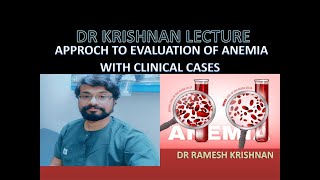 Approch to Evaluation of Anemia With Clinical cases part 1 Microcytic Anemia [upl. by Occer]