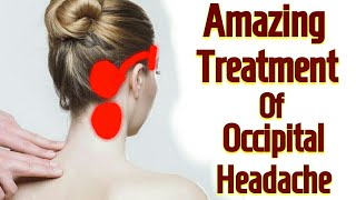 Acupressure Point For OCCIPITAL NEURALGIA  Occipital HEADACHE In Hindi [upl. by Nagey]