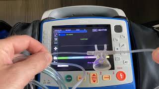 Capnography Overview Full VideoZOLL Tips and Tricks [upl. by Sadonia]