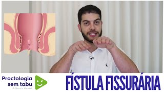 Fístula fissurária O que é Como tratar [upl. by Annamarie]