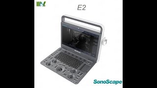 sonoscape E2 E3 ultrasound scan for abdominal [upl. by Eihctir]