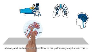 MedEd capnography byte 4 Ventilation perfusion mismatching [upl. by Cletis]