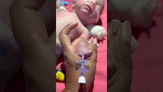 Iv Cannula medical newbornbaby viralvideo [upl. by Mansfield648]