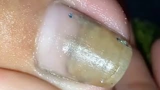 How to Cleaning nail [upl. by Shep315]