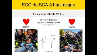 ECG du syndrome coronaire aigu Les équivalents ST à haut risque P Taboulet [upl. by Nivac]