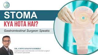 Stoma Bag Kya hai Colostomy in Hindi  Stoma Care I Dr Chintamani Godbole  GI Cancer Specialist [upl. by Sivrad296]