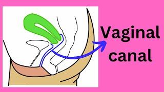 Vaginal canal  Fornices  Orifice  Hymen [upl. by Sokram982]