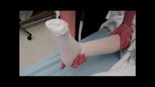 CNA Essential Skills  Apply One KneeHigh Elastic Stocking 413 [upl. by Lucian409]