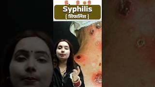 सिफलिस Syphilis रोग  Syphilis Causes Symptoms Treatment  STD disease Shorts Science PW [upl. by Tony]