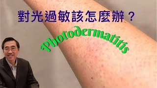 《對光過敏該怎麼辦？》｜Photodermatitis [upl. by Chainey]