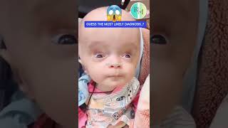 health exam test diagnosis treatment viral vims hydrocephalus pediatrics pediatricians [upl. by Alleusnoc]