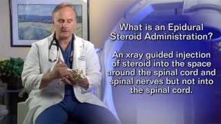 Epidural Steroid InjectionPatient Education Video [upl. by Eeltrebor]