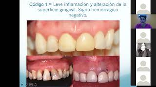 clase ficha y periodontograma [upl. by Aniuqahs138]