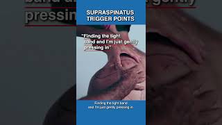 How to Release Supraspinatus Trigger Points [upl. by Carlita]