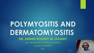 8 PolymyositisDermatomyositis PMDM [upl. by Meghan]