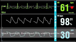 Patient monitor displays medical exam vital signs [upl. by Trebreh709]