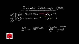 Internuclear ophthalmoplegia INO BASIC amp QUICK EXPLANATION [upl. by Eart]