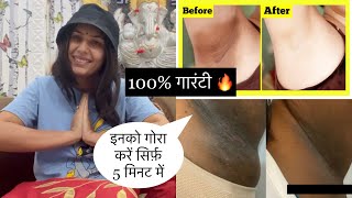 Underarms Whitening At Home  Bas 5 Min me Underarm Gore Kare  Home Remedy Tips  Dr Upasana Vohra [upl. by Iasi]