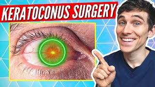 What is Corneal Collagen Crosslinking Keratoconus Treatment Explained [upl. by Bobbette]