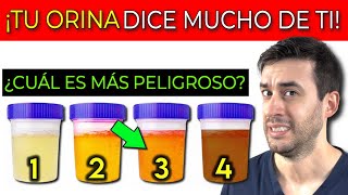 ¡Lo que tu ORINA DICE DE TU SALUD 4 SÍNTOMAS INICIALES de INSUFICIENCIA RENAL [upl. by Forrer766]