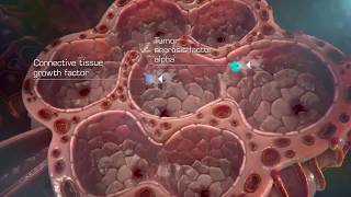 Idiopathic Pulmonary Fibrosis IPF Pathogenesis HD [upl. by Hayyim103]