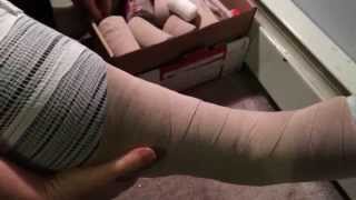 Lymphedema Self BandagingLeg lower extremity [upl. by Heringer]