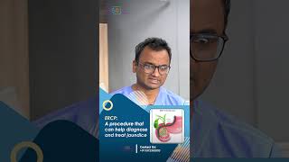 ERCP or PTBD Which is More Effective for Jaundice in Bile Duct Cancer  Dr Praveen Kammar [upl. by Allisan]