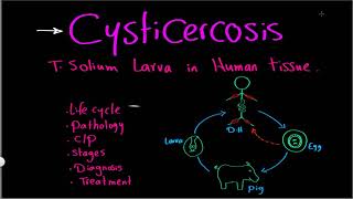 Parasitology 10 Cysticercosis amp H nana »DrMoaz [upl. by Annua493]