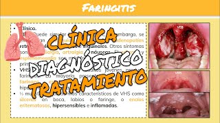 ⚕️🩺FARINGITISFARINGOAMIGDALITIS y HERPANGINA SíntomasTratamiento [upl. by Arima11]