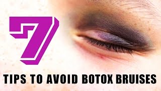 Bruising from Botox  7 tips to avoid Botox Bruises [upl. by Siednarb236]