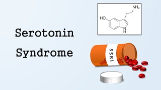 Serotonin Syndrome [upl. by Syverson]