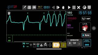 Defibrillation and Cardioversion [upl. by Rocco464]