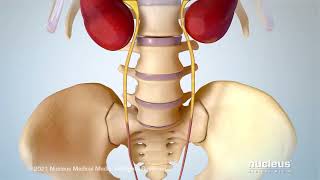 Stress Urinary Incontinence SUI [upl. by Ecirtal]