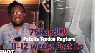 Patellar Tendon Rupture Recovery Week 1112  75 Hard [upl. by Kazimir776]