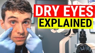 What Causes Dry Eyes Eye Doctor Explains Dry Eye Syndrome [upl. by Amand]