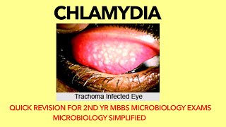 Chlamydia  Microbiology  Bacteriology Trachoma Quick revision for 2nd yr MBBS microbiology exams [upl. by Luisa]