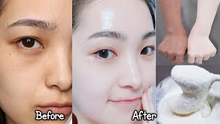 Japanese secret to whitening skin and get rid of pigmentation to get a fresh complexion [upl. by Ahsenik852]