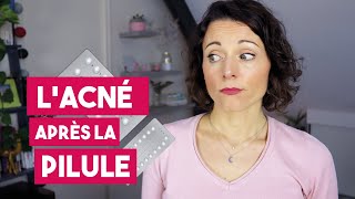 Comment gérer lacné hormonale après larrêt de la pilule [upl. by Homer]