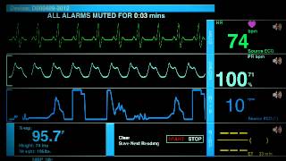 Sonido De Un Hospital [upl. by Enilrad525]