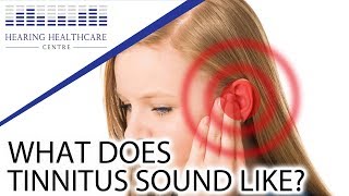 What Does Tinnitus Sound Like [upl. by Laurita]