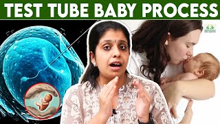 Test Tube Baby Treatment Tamil  Dr Deepthi JammiCwc  IVF procedure  infertility fertility [upl. by Vharat246]