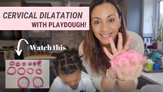 Cervical Dilatation With Playdough  Labour amp Birth  Midwife Marley [upl. by Eneryt]