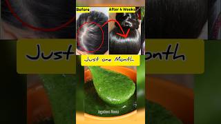 😱உங்க தலையில் முடி இல்லையா Just One Month 🔥Get New Hair😱 baldness tips [upl. by Maier43]