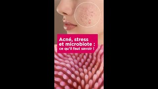 ACNÉ STRESS ET MICROBIOTE  CE QU’IL FAUT SAVOIR [upl. by Alcine]