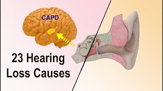 Hearing Loss Causes  23 Different Reasons Why Hearing Loss Occurs [upl. by Ecirtak420]